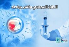 الحقن المجهري